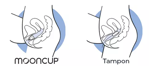 Position of the Mooncup® in comparison to a tampon