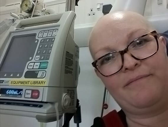 Jo during chemo for ovarian cancer