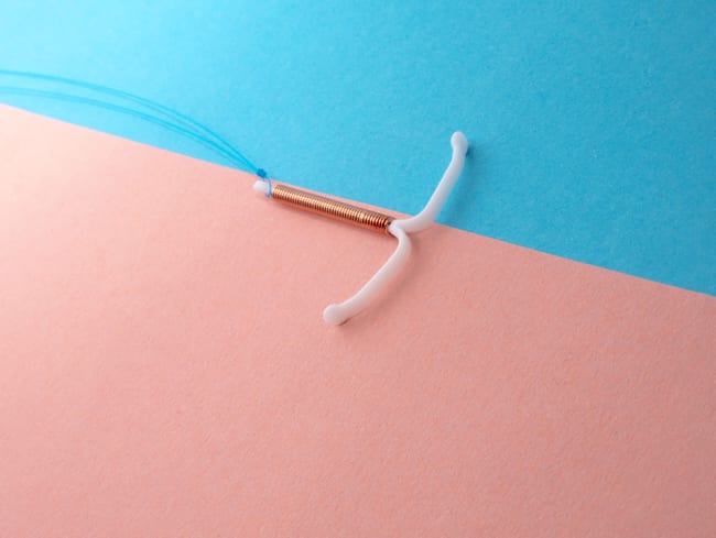 IUD (intrauterine contraceptive device)