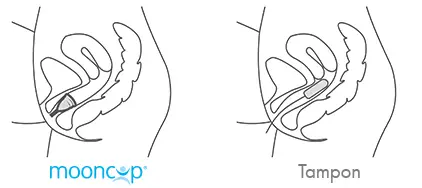 diagram showing positioning of a Mooncup vs tampon